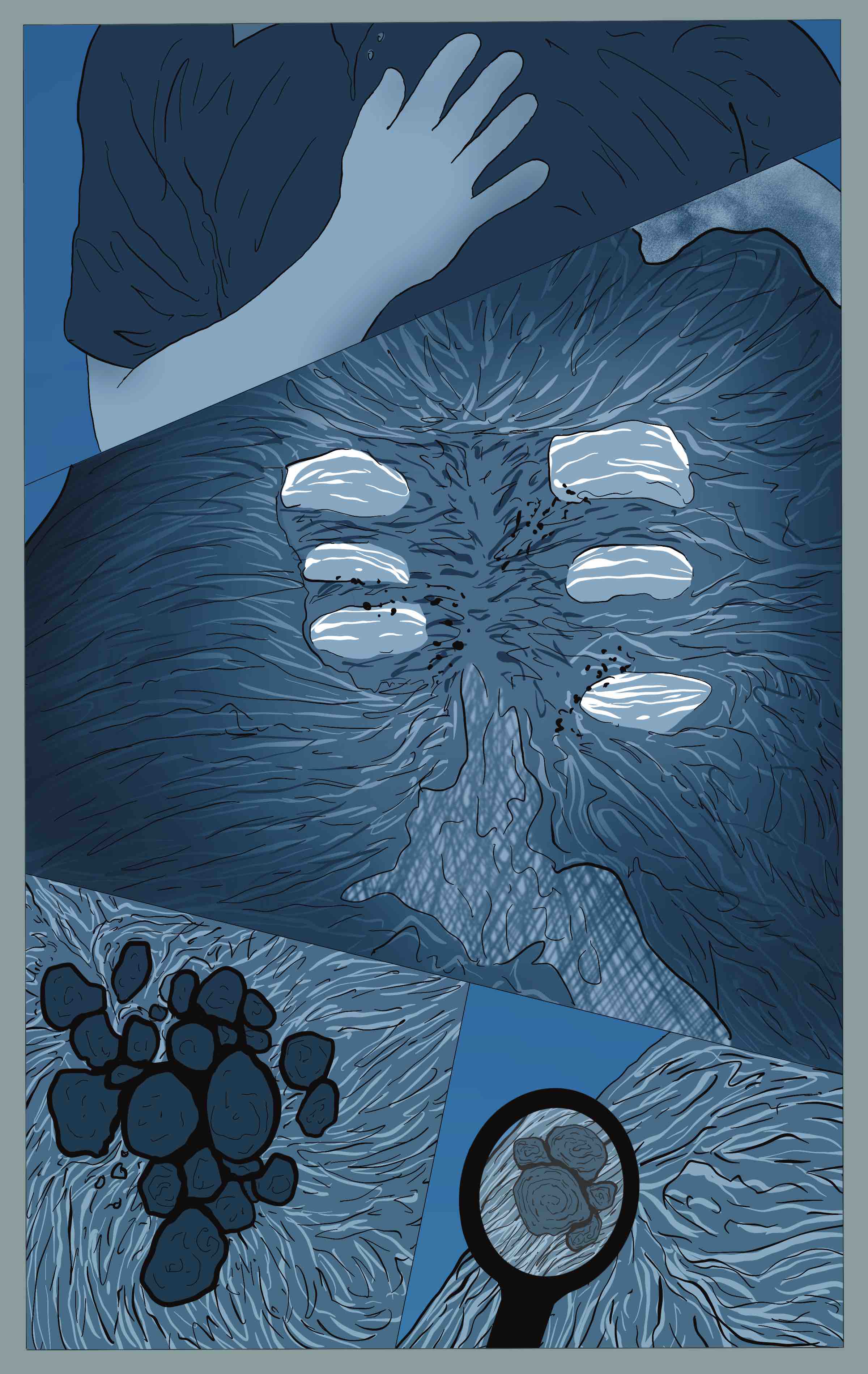 Fig. 6. The Medusa virus causing a cytokine storm in the lungs that ultimately leads to extreme fibrosis